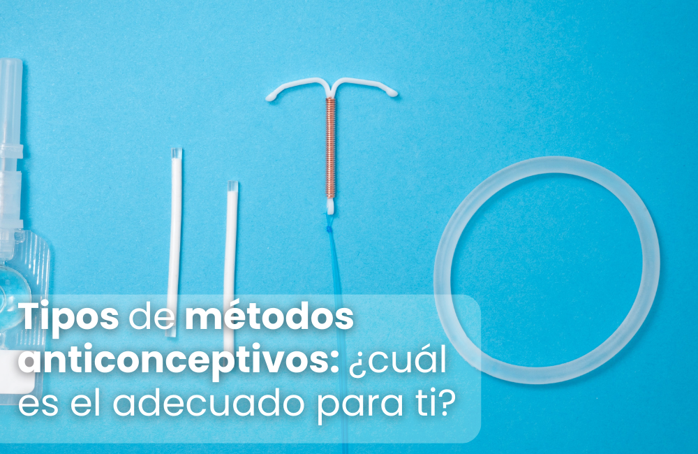 Tipos de métodos anticonceptivos: ¿cuál es el adecuado?