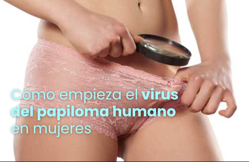 Cómo empieza el virus del papiloma humano en mujeres