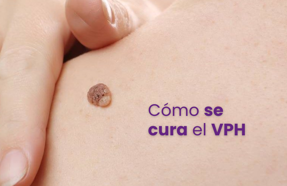 Cómo se cura el VPH