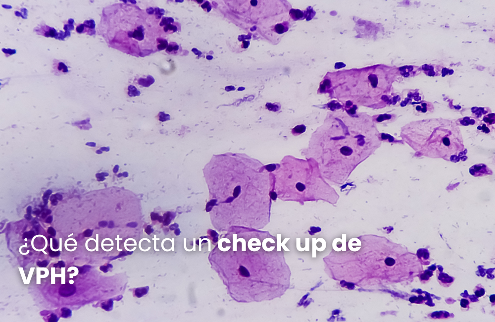 ¿Qué detecta un check up de VPH?