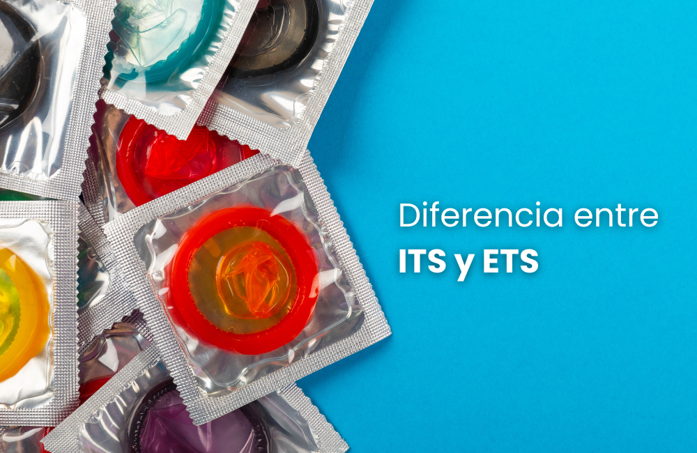 Diferencia entre ITS y ETS